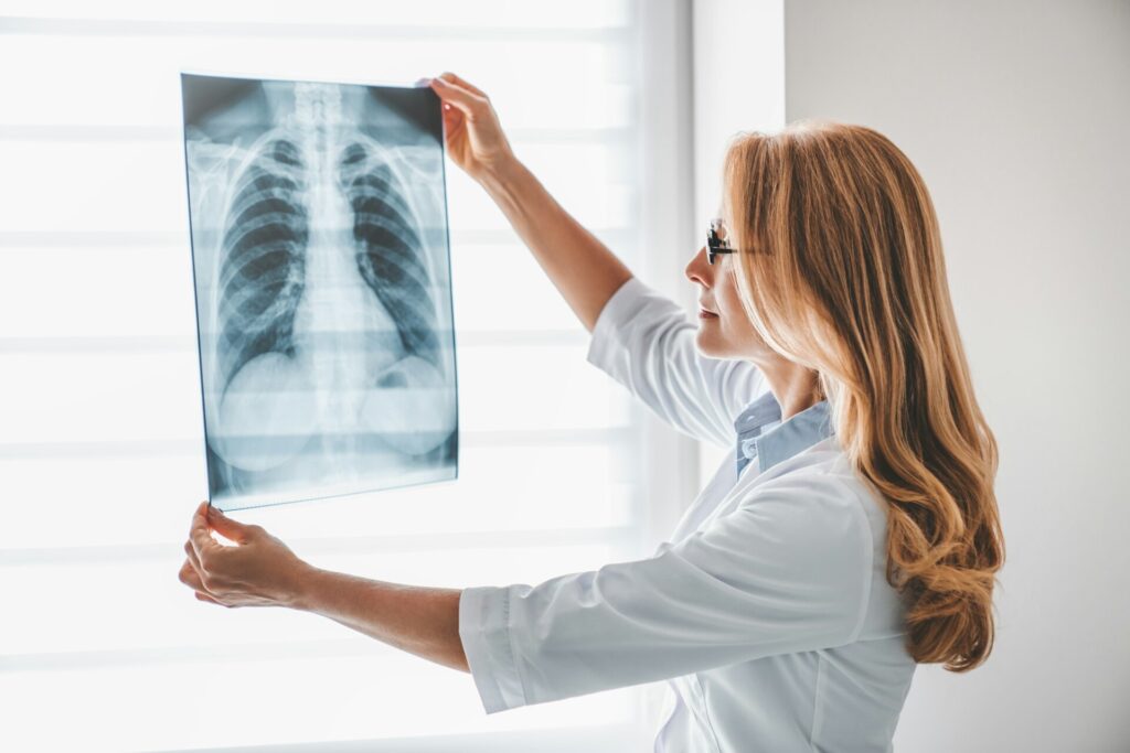 Caucasian adult female doctor looking at x-ray