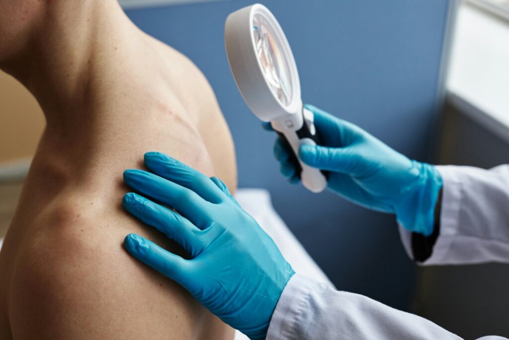 Doctor using magnifying glass in dermatology clinic