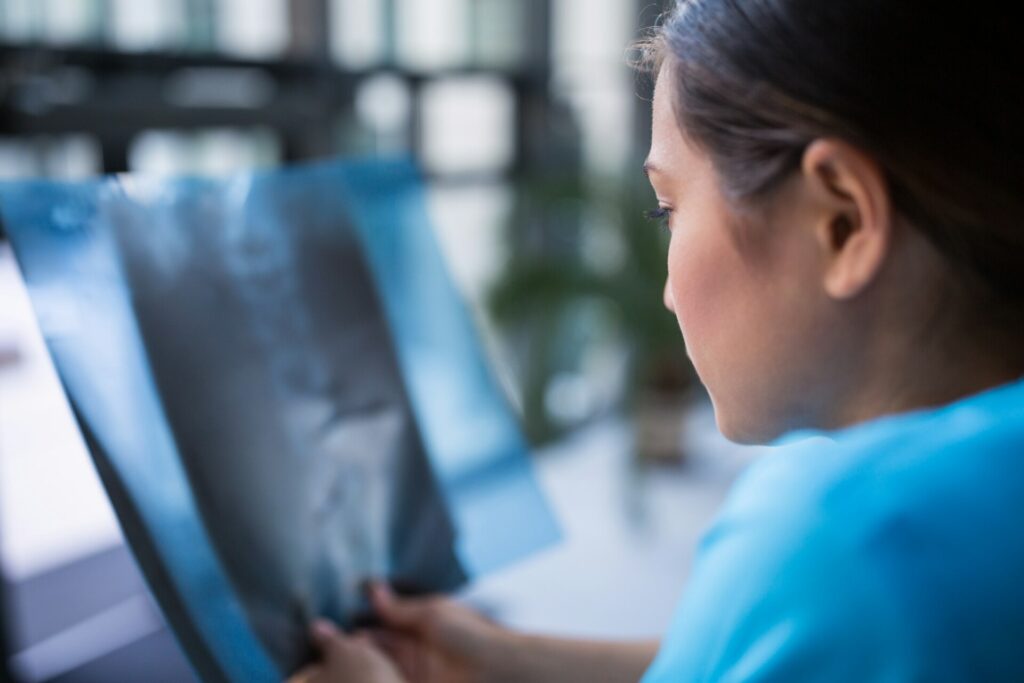 Nurse examining X-ray report