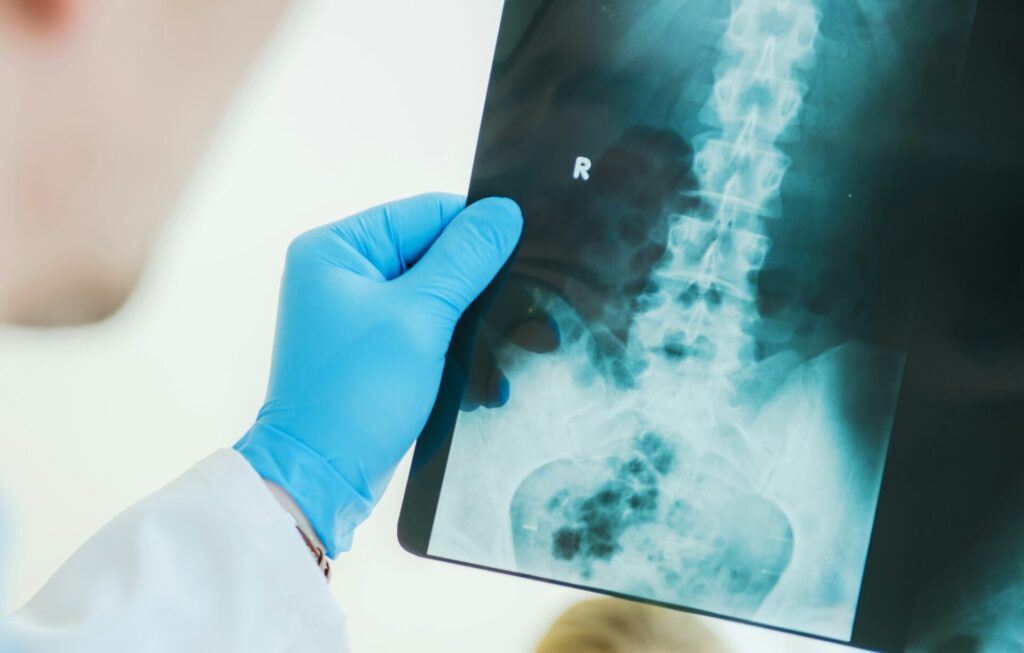 Radiologist Examining X Ray Image